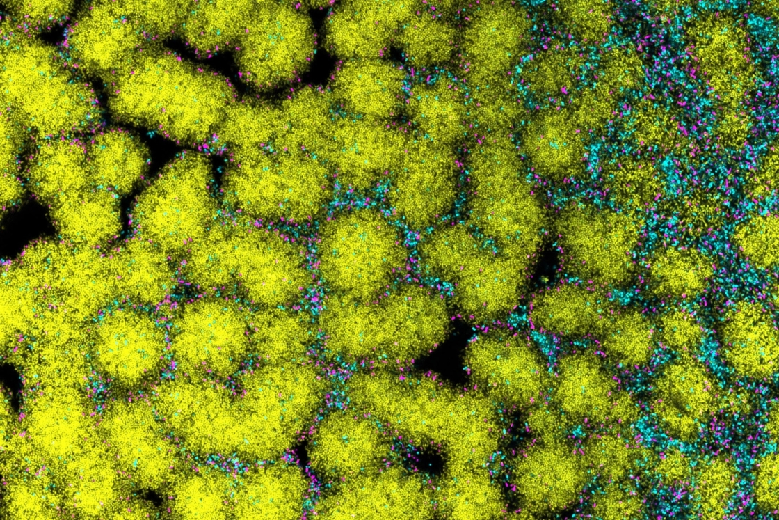 Microscopy image showing a biofilm