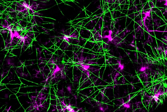 mature brain cells called oligodendrocytes
