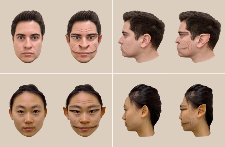 Side-by-sides of normal faces and their distortions