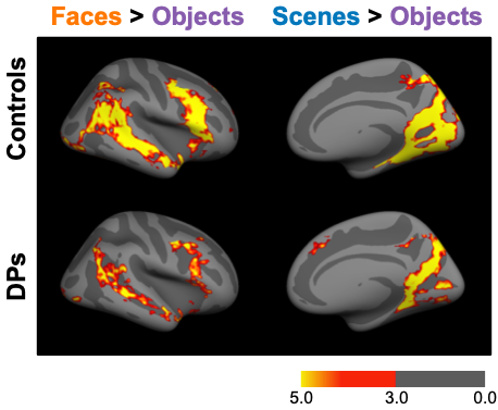 regions of the brain