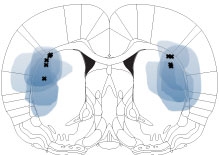 brain illustration shows two blue orbs