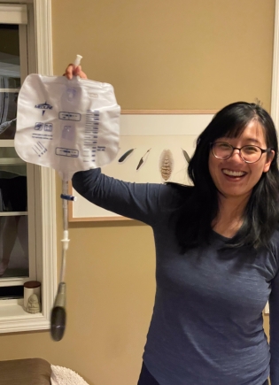 Mimi Lan showcasing urine bag